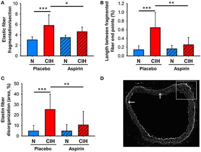 Acetylsalicylic Acid Prevents Intermittent Hypoxia-Induced Vascular Remodeling in a Murine Model of Sleep Apnea